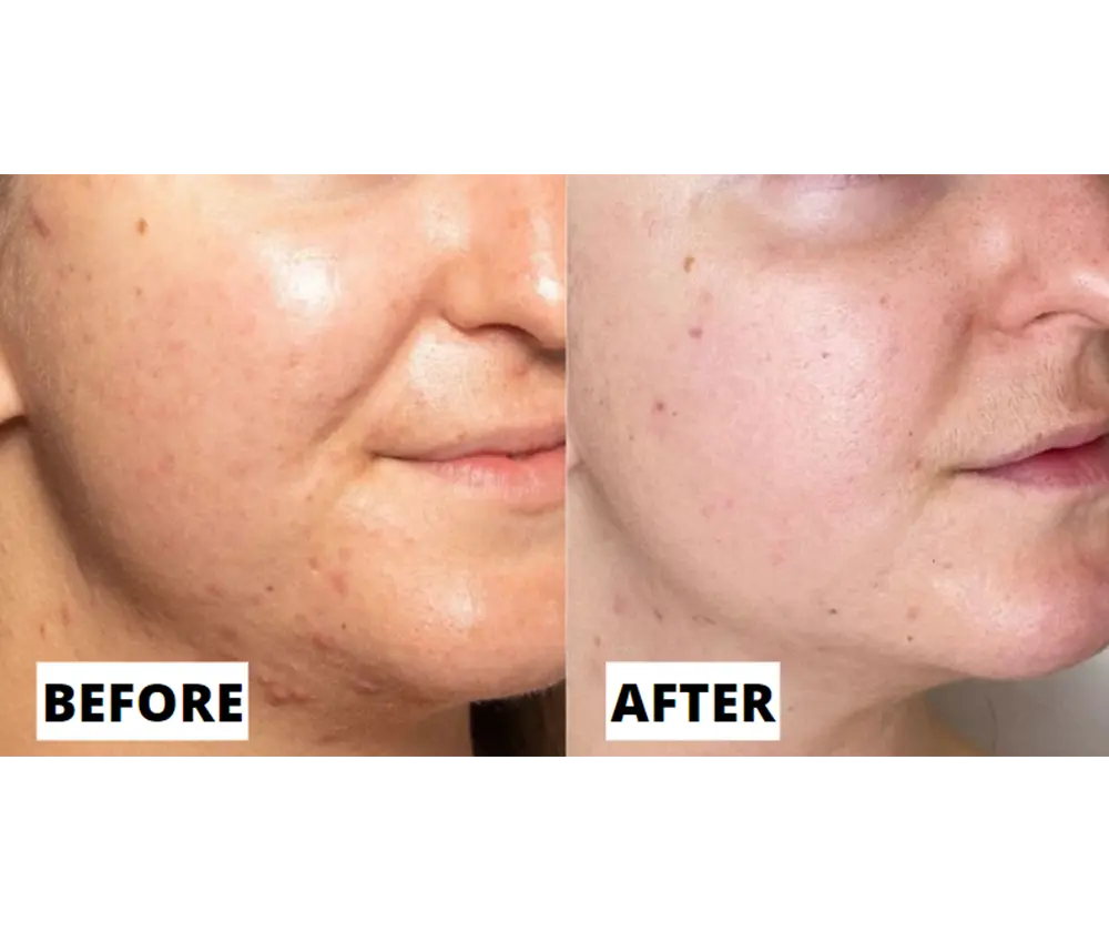 Real results before and after