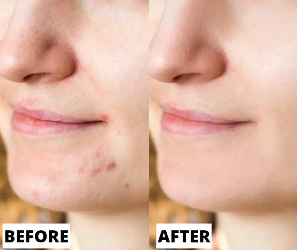 Real results before and after