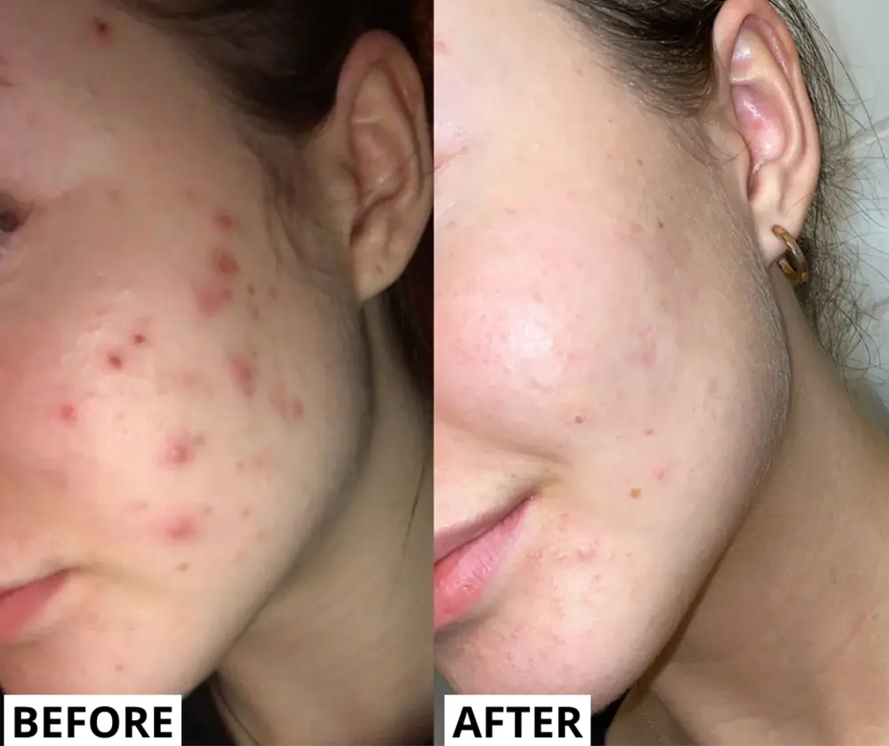 Real results before and after