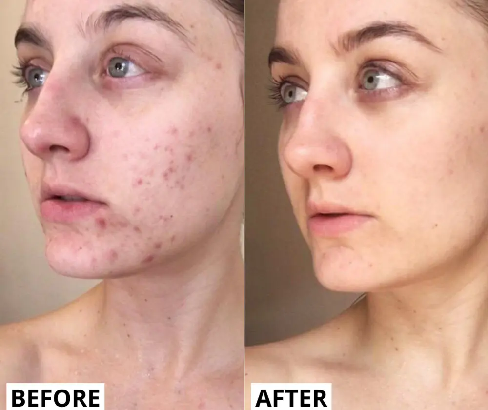 Real results before and after