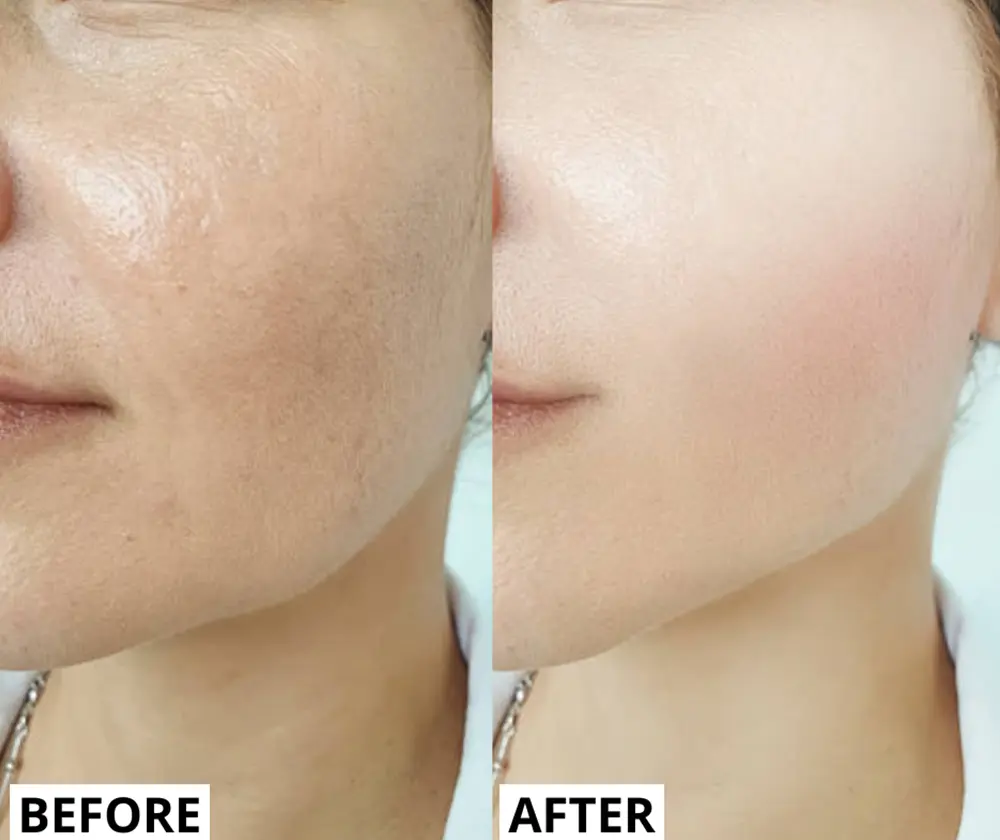 Real results before and after