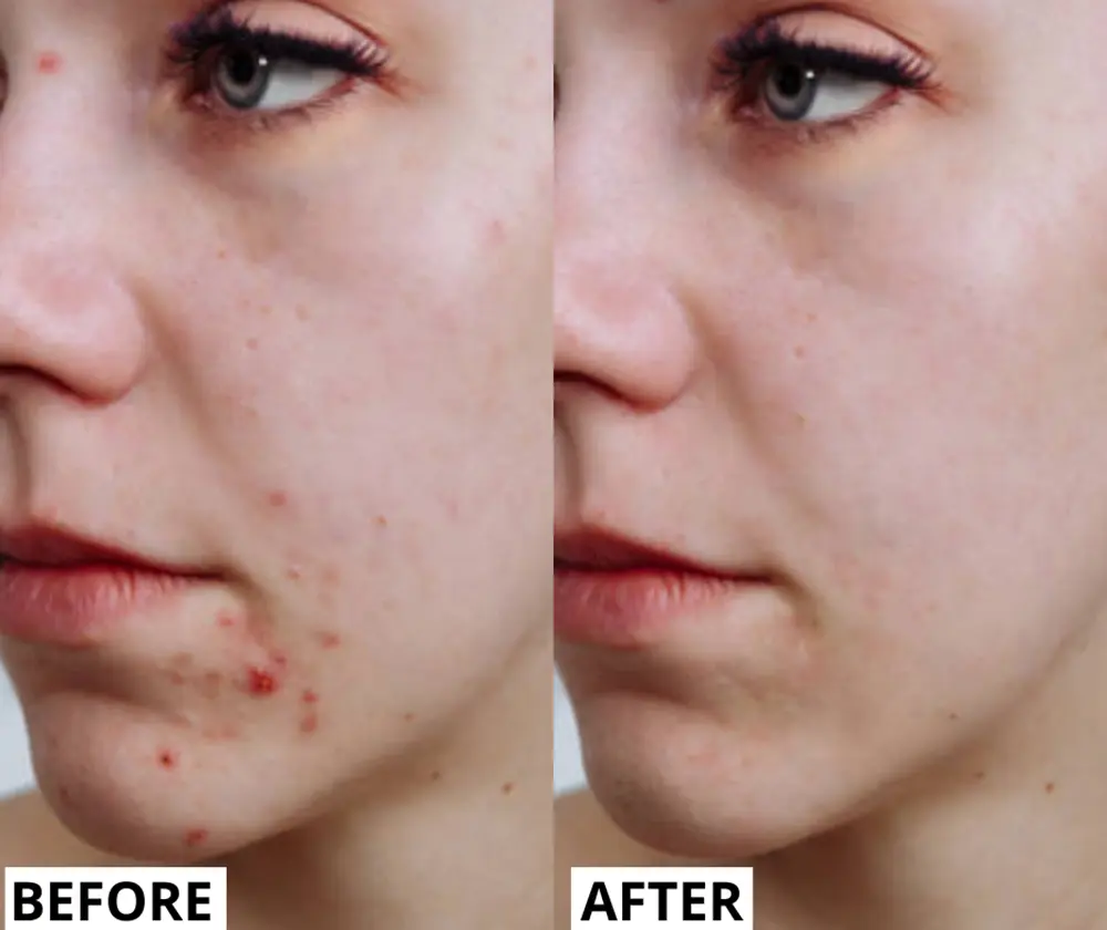 Real results before and after