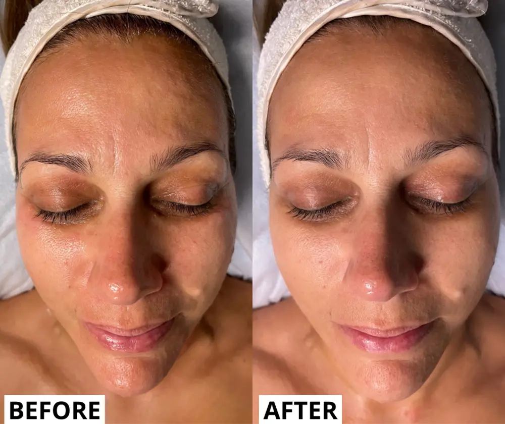 Real results before and after