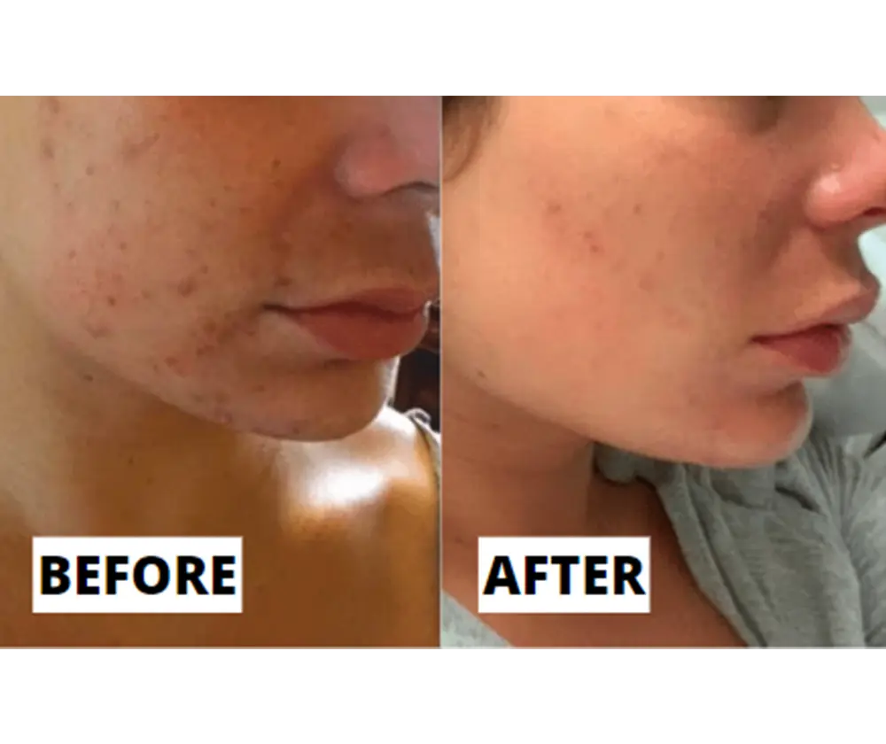 Real results before and after