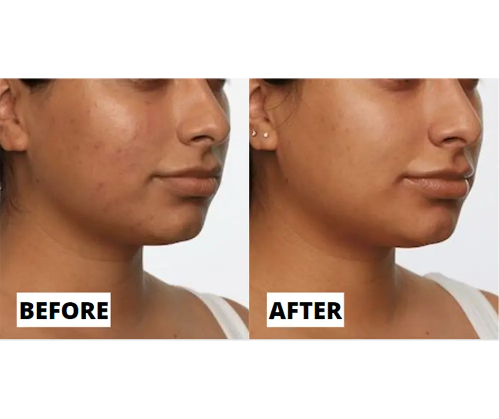Real results before and after