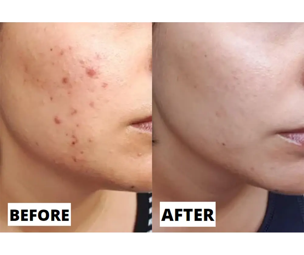 Real results before and after